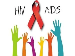 HIV and AIDS HIV and AIDS
